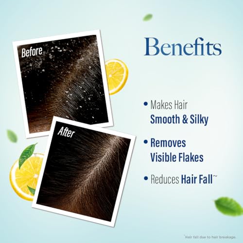 Kesh King Ayurvedic Anti-Dandruff Shampoo | Reduces hair fall | Soothes itchy scalp | No Paraben & No Silicon | 21 natural ingredients | Enriched with curd, lemon & neem | 1000 ml