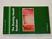 The Burning Mouth Syndrome 8716103815 Book Cover