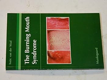 Paperback The Burning Mouth Syndrome Book