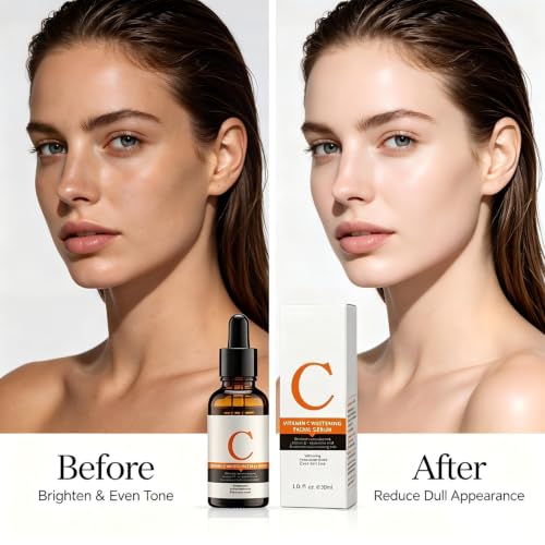 Image of Dark Spot Corrector With Anti-Aging Melasyl + 10% Niacinamide, Discoloration Correcting Serum for Sun Spots, Age Spots & Post-Acne Marks Korean Skincare | 1.01 fl.oz. (Vitamin C essence)