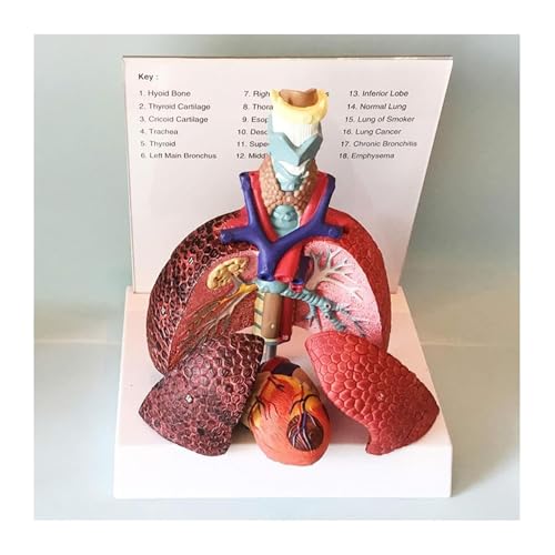 Cœur et larynx AMITD taille réelle pour comprendre les maladies facilement - 5