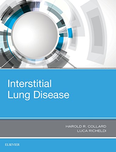 Interstitial Lung Disease E-Book Interstitial Lung Disease E-Book