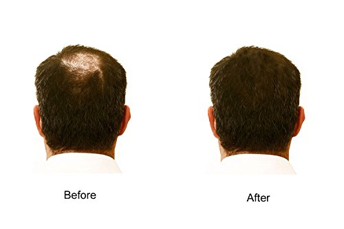 Hair Enhancer Spray para cabello fino o ralo - 3 latas de 5 oz miniatura 3