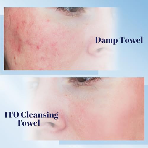 Image of ITO Face Towels, Ultra-Soft & Extra Thick Cleansing Towels for Sensitive, Dry & Oily Skin, Facial Tissue, Makeup Remover Disposable Towels (60 Count (Pack of 3))