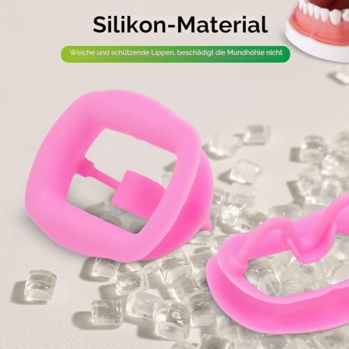 2 Stück Dental-Mundöffner, wiederverwendbar, autoklavierbar, Silikon, Zahnaufhellung, Wangenhalter, Lippenhalter für Zahnarzt, Mundinspektion, Mundschutz, Challenge-Spiel (Rosa)