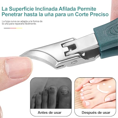 Opiniones y reviews de Desenterrador de uñas Top 5. 27 Imagen adicional