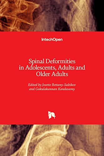 Spinal Deformities in Adolescents, Adults and Older Adults