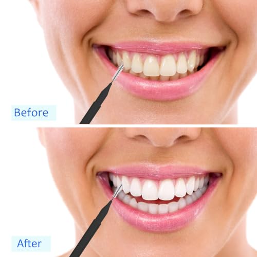 Image of Patelai 100 Pieces Braces Dental Brush for Cleaner Interdental Toothpick Dental Tooth Flossing Head Oral Hygiene Flosser Toothpick Cleaners Tooth Tool (White,Blue,Black,Mixed Size)