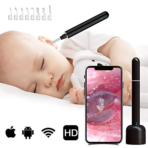 BOKA Digital Otoscope Camera, Ear Wax Removal Otoscope for iPhone,1080P HD Ear Scope