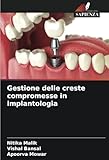 Gestione delle creste compromesse in implantologia (Italian Edition)