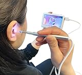 4.3インチモニター付き 耳かき器 内視鏡付き耳かき器 SLI-MEC39