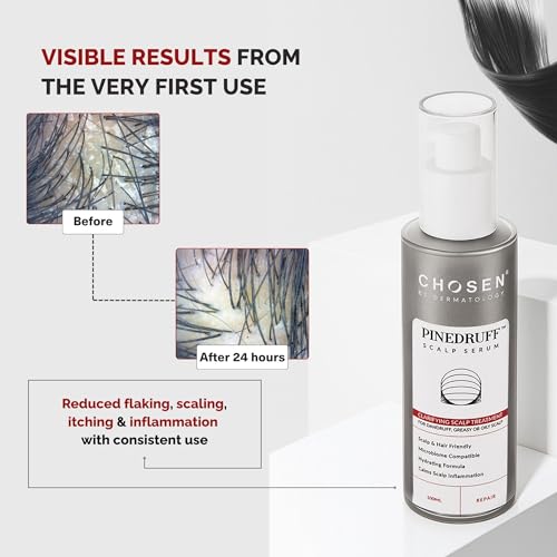 Image of Pinedruff Antidandruff Pycnognol Scalp Serum | Antioxidant-Rich Formula for Scalp Hydration & Dandruff Control | Soothes Dryness & Supports Scalp Health | Suitable for Teens & Adults | 100 ml