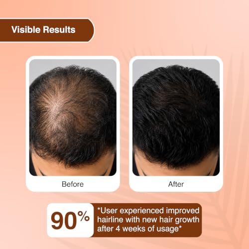 Image of Advanced Hair Growth & Scalp Serum - 3% Redensyl, 4% Anagain, 2% Baicapil, Caffeine & Keratin | Hair Fall Control Serum for Frizzy, Thinning Hair | Men & Women, 30ml (Pack of 1)