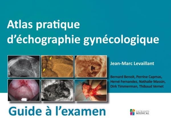 Atlas pratique d'échographie gynécologique: Guide à l'examen