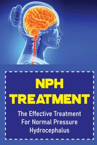 NPH Treatment: The Effective Treatment For Normal Pressure Hydrocephalus