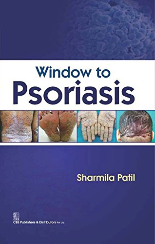Window to Psoriasis