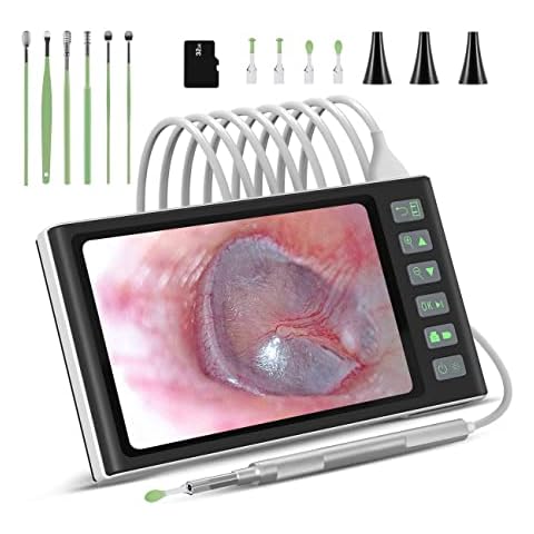 Digital Otoscope with 7 Inch IPS Screen, Hiacinto Ear Wax Removal Tool Camera, 3.9mm HD Ear Scope Otoscope with Light, Ear Camera and Wax Remover, Supports Photo Snap and Video Recording, 32GB Card Cover