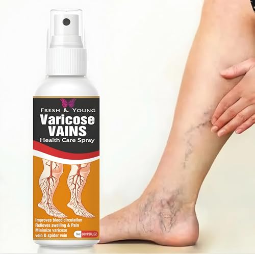 Image of Fresh & Young Varicose Veins Spray | Natural Formula for Fast Relief | Reduces Swelling, Relieves Pain & Improves Blood Circulation | Easy-to-Use Spray for Legs & Feet - 50 ml