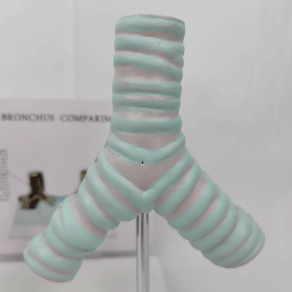 Human Trachea Anatomy Model, Smoking Trachea and Normal Trachea Comparison Model, Respiratory System Structure Organ Anatomy, for Medical Teaching Display.
