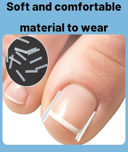 Image of 10 PCS Toenail Corrector Strips, Toenail Support Strips, Breathable Nail Care Patches for Daily Comfort Ingrown Toenail Pain Reliever