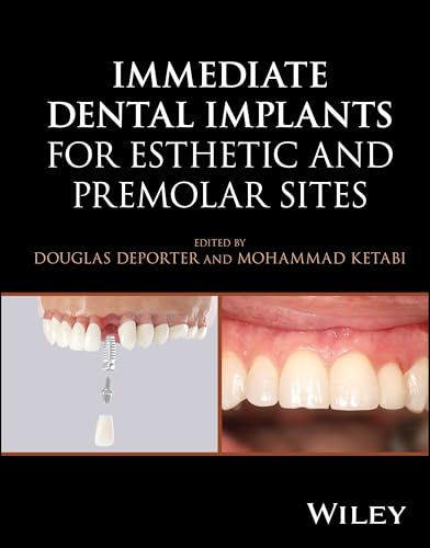 Immediate Dental Implants for Esthetic and Premolar Sites