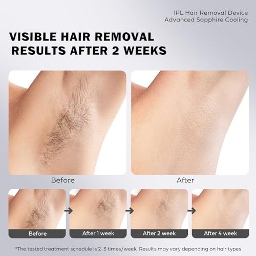FDA Cleared IPL Laser Hair Removal Device, 18.9J High Power with Sapphire Crystal Cooling, Dual Pulse & 2-Week Results, Low-Temp Painless, Elegant Design with Gift & Travel Case for Home Use - Image 5