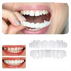 Neptanden Veneers Tijdelijke Gebitsprothese Snap in Tanden Vertrouwen Glimlach Kunstgebit Veneers Nep Voor Mannen En Vrouwen Slechte Tanden Bleken Alternatief,2 pairs