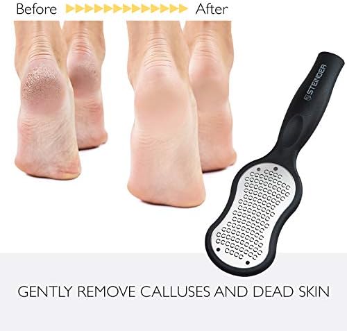 Steinder Foot File, Feet Scrubber for Hard Skin, Heel Scraper Dry Skin, Rough Skin Remover for Feet, Foot Pedicture Kit, Foot Rasp - Black