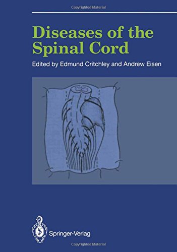 Buy Diseases of the Spinal Cord — BookShops.in