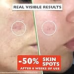 Vitamin C Serum For Face – Anti-Aging Facial Serum with Vitamin C, Hyaluronic Acid, Niacinamide, B5 & Vit E. Brightening Facial Essence for Dark Spots, Fine Lines, Wrinkles & Glowing Skin, 2 Fl Oz - Image 4