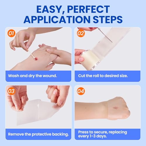 Image of Hydrocolloid Roll Adhesive Bandages Medical Grade Pimple Tape, 2in x 5ft