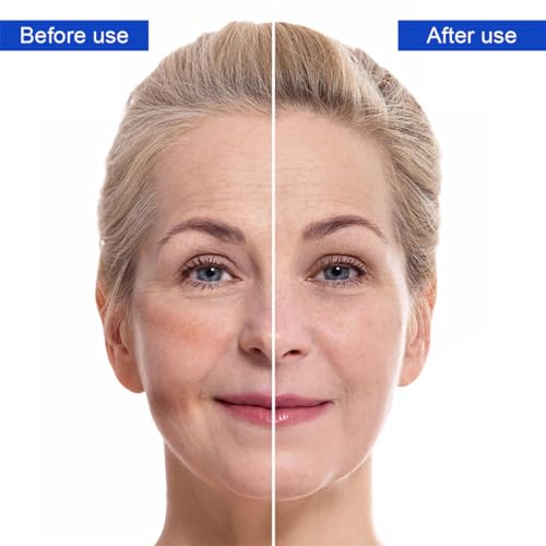 CPAP Gurtbezüge CPAP Maske Kopfband Gurtbezüge 4 Pack Bequem Gesichtspads für Verringerung von Wange Rote Flecken und Einbuchtungen