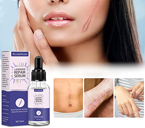 Skin Repair Essence - Unisex Moisturizing Skin Care Products Lavender Repair Essence 30ml Stretch Mark Removal Cream, Stretch Marks Relief & Burns Repair