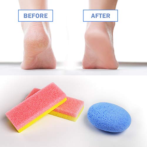 Foot Pumice Stone for Feet Set, Includes 2 PCS Pedicure Glass Stone for Heavy Callused Feet, 2 PCS 2 in 1 Foot Scrubber Sponge for Hard Dead Skin Callus Remover