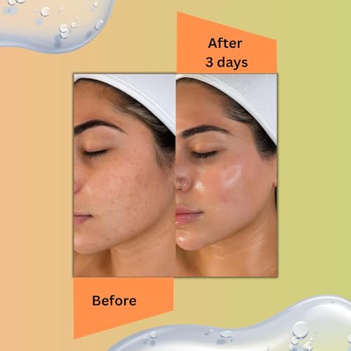 Image of D-TAN Removal Cream Pack for Face & Body | No Bleach | Lactic Acid & Kojic Acid | Brightening & Moisturizing Tan Removal for Men & Women | All Skin Types - 250g