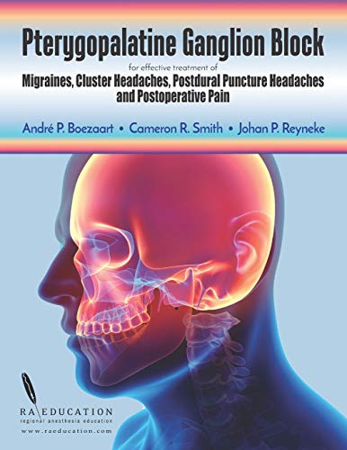 Pterygopalatine Ganglion Block for Migraine and Headache