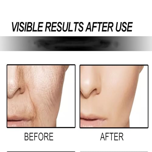 Polypeptide Collagen Skin Firming Cream - Anti-Wrinkle Lotion