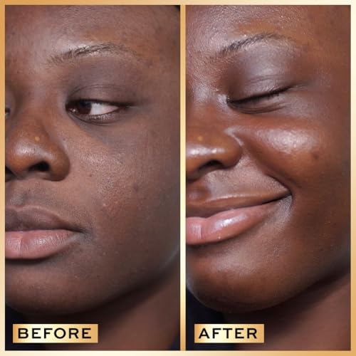 Image of Revolution Pro Miracle Serum Hydrating Face Serum, 1 oz | Helps Dullness & Uneven Skin Tone with Hyaluronic Acid & Niacinamide, Vegan & Cruelty-Free