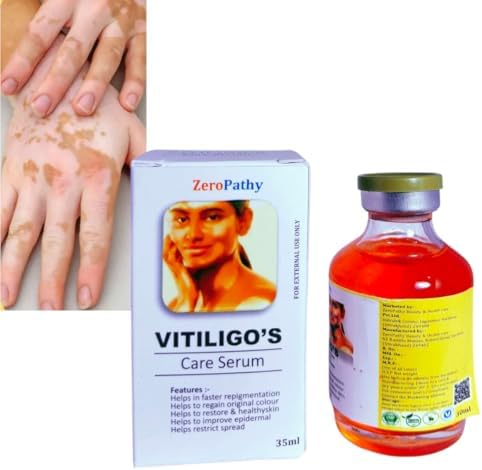White Spot Ointment,Safed Daag Ke Liye,Natural Vitiligo with Turmeric, Aloe Vera & Ginseng, Designed to Restore Skin Pigmentation,Moisturing Disease Treatments Tag Remove Serum