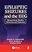 Epileptic Seizures and the EEG: Measurement, Models, Detection and Prediction