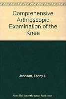 Comprehensive Arthroscopic Examination of the Knee 0801625343 Book Cover