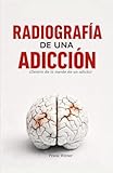 Radiografia de una adicción: Dentro de la mente de un adicto