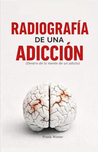 Radiografia de una adicción: Dentro de la mente de un adicto