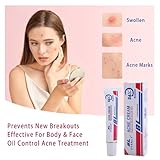 Acne Cream Scar Treatment Fast Acting - 24-Hour Spot Reduction, Anti Acne Formula, Sensitive Skin Safe, Includes Rapid Acne Scar Removal, Moisturiser, Deep Pore Cleansing - 15g - Image 5