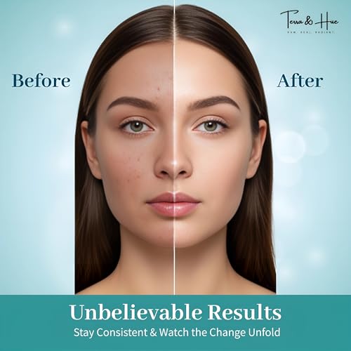 Image of Terra & Hue Korean Glass Skin Overnight Collagen Face Mask with Facial Headband and Glow Tracker for Young, Glowing Skin, 2X Natural Bio Collagen, 4X Hydration, Pigmentation, Pore Minimizing, Collagen Mask Overnight, Pack Of 2