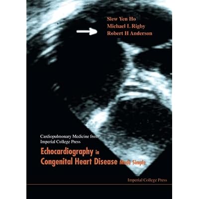 Echocardiography In Congenital Heart Disease Made Simple