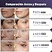 Imagen de Aparato Radiofrecuencia Facial