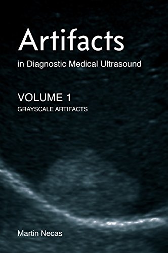 Artifacts in Diagnostic Medical Ultrasound: Grayscale Artifacts