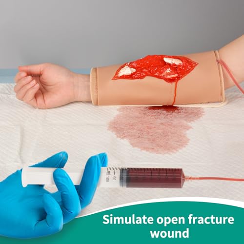 Modèle d'éducation médicale pour fracture ouverte et pansement d'urgence