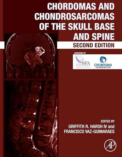 Chordomas and Chondrosarcomas of the Skull Base and Spine (English Edition)